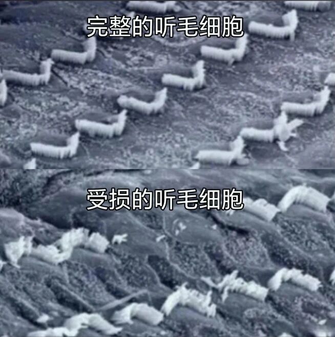 “听得到听不清” 又是这个话题
